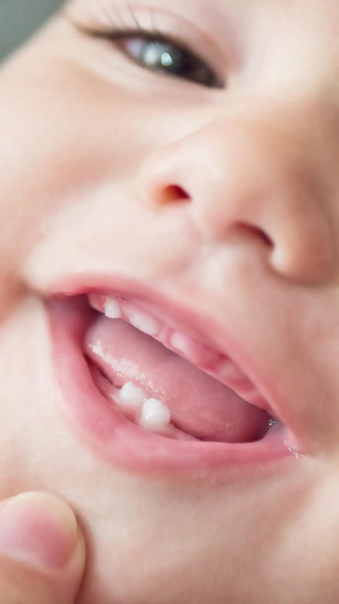 Memberikan Makan saat Tumbuh Gigi