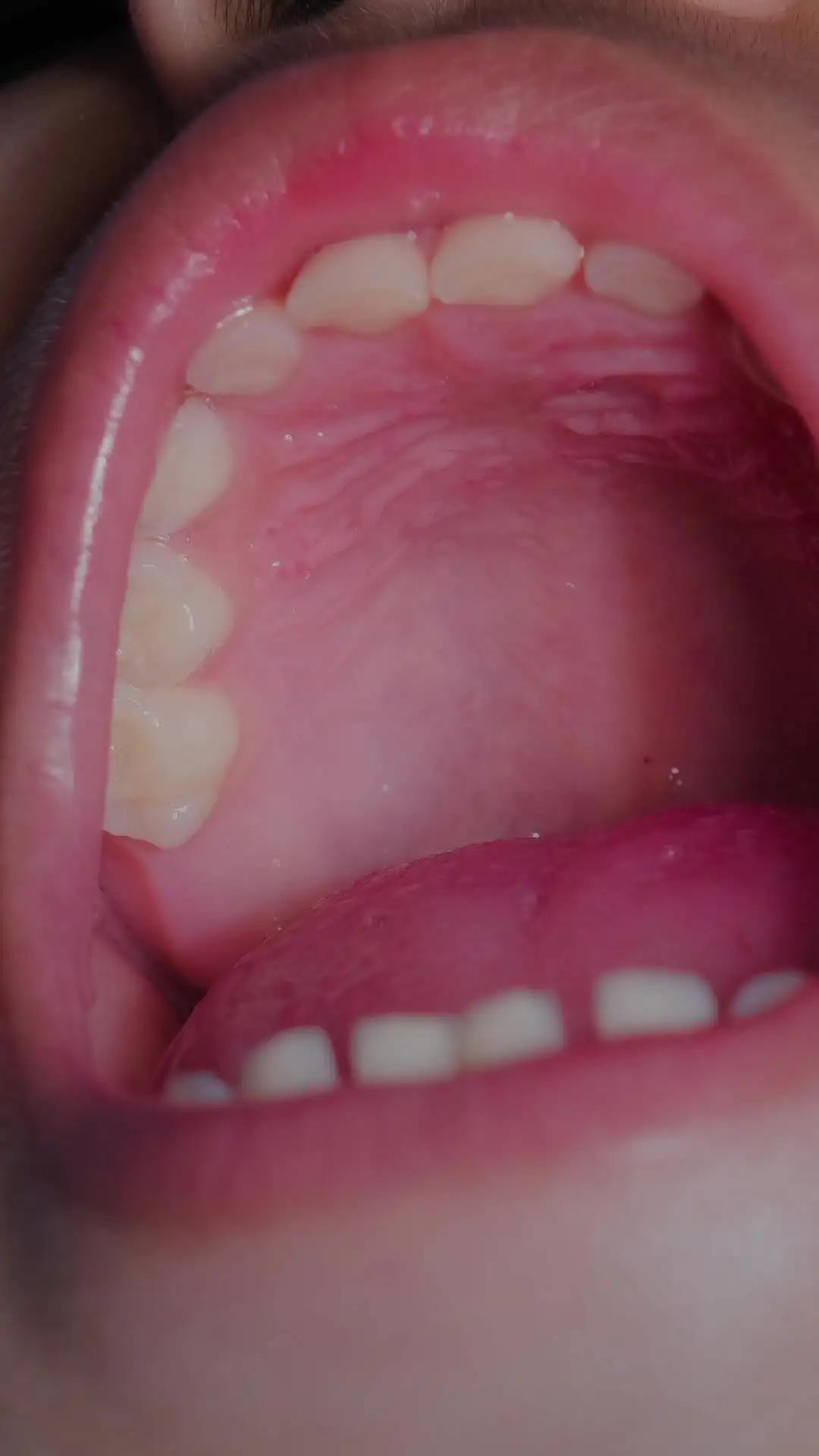 Apakah Saat Nyeri, Tetap Ditahan Untuk Lanjut Menyusui?