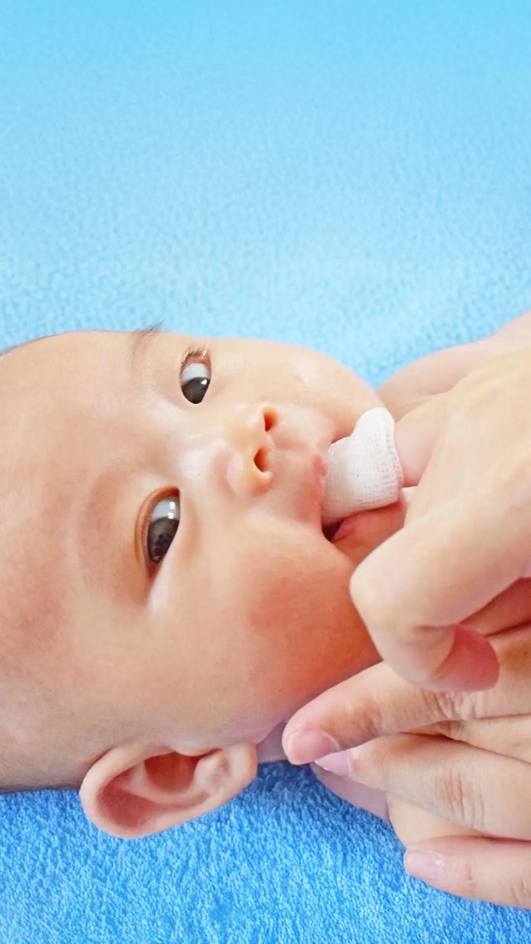 Lidah Putih : Infeksi Jamur atau Sisa Susu?